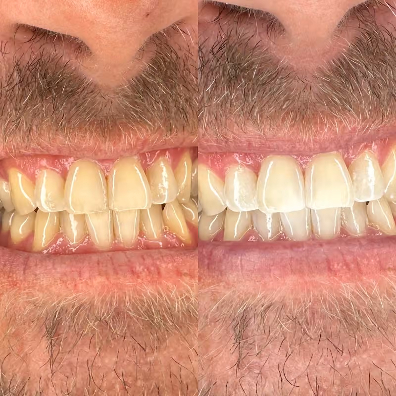 C’s Pearly Whites