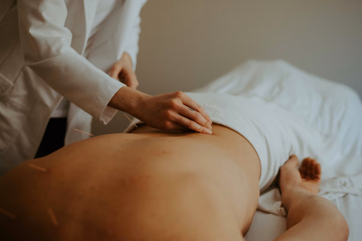 Cochrane TCM Acupuncture