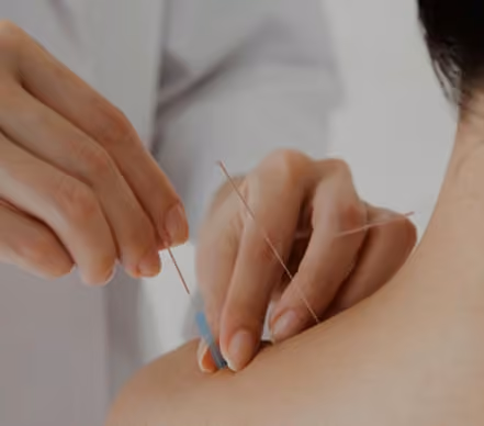 Completely Healthy Acupuncture