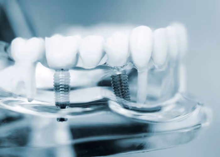 Kitchener Waterloo Prosthodontics in Kitchener, Ontario