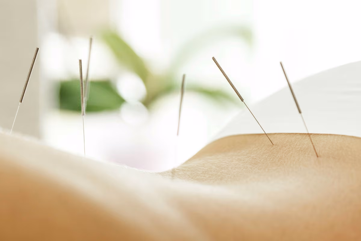 Lethbridge Acupuncture & Chinese Herbal Clinic