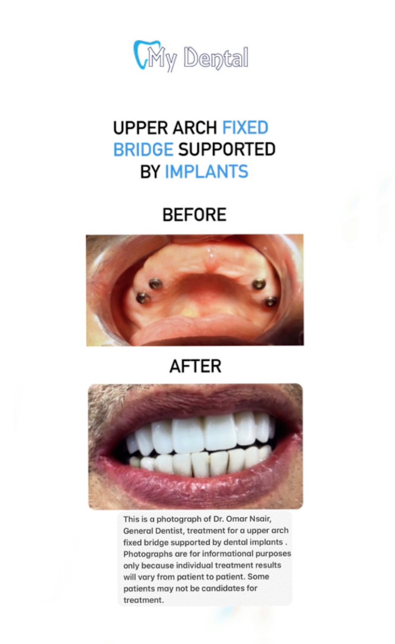 My Dental in Edmonton, Alberta