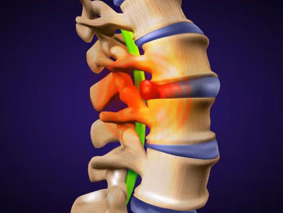 Quinte Decompression & Pain Clinic