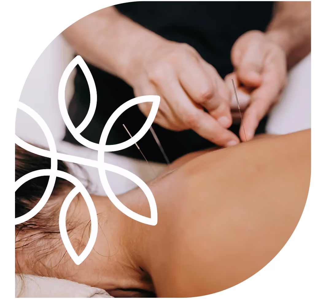 Tranquility Acupuncture & Wellness Clinic